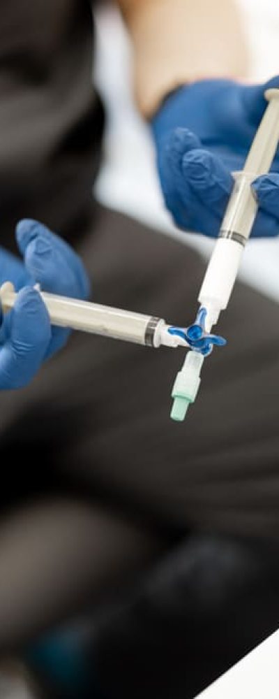 escleroterapia com espuma 2